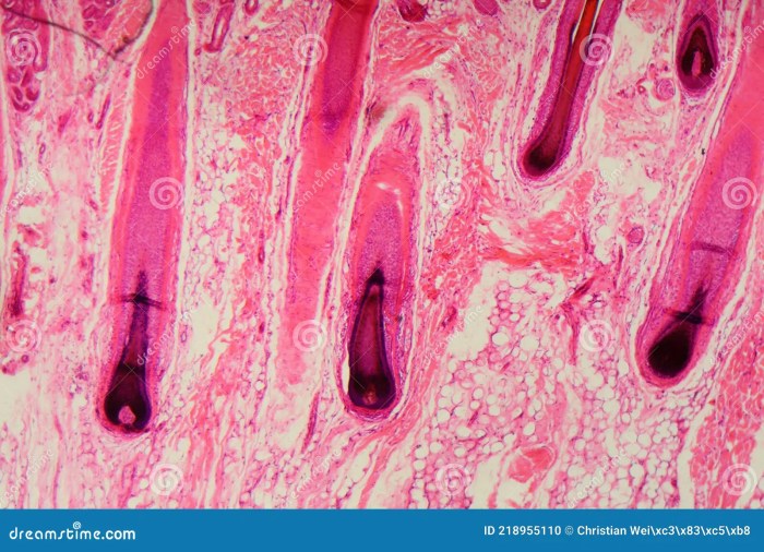 Hair follicle under microscope labeled