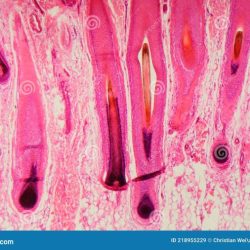 Hair follicle under microscope labeled