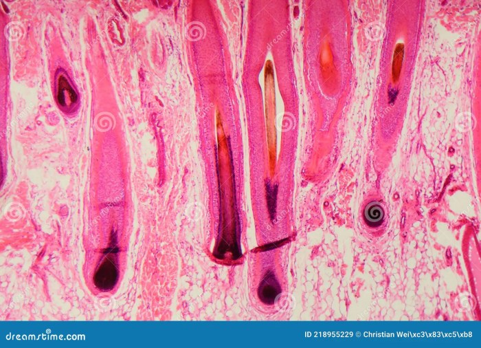 Hair follicle under microscope labeled